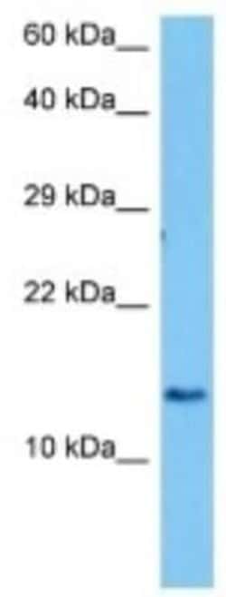 IGKV6-17 Rabbit anti-Mouse, Polyclonal, Novus Biologicals 100 &mu;g; Unconjugated:Antibodies,